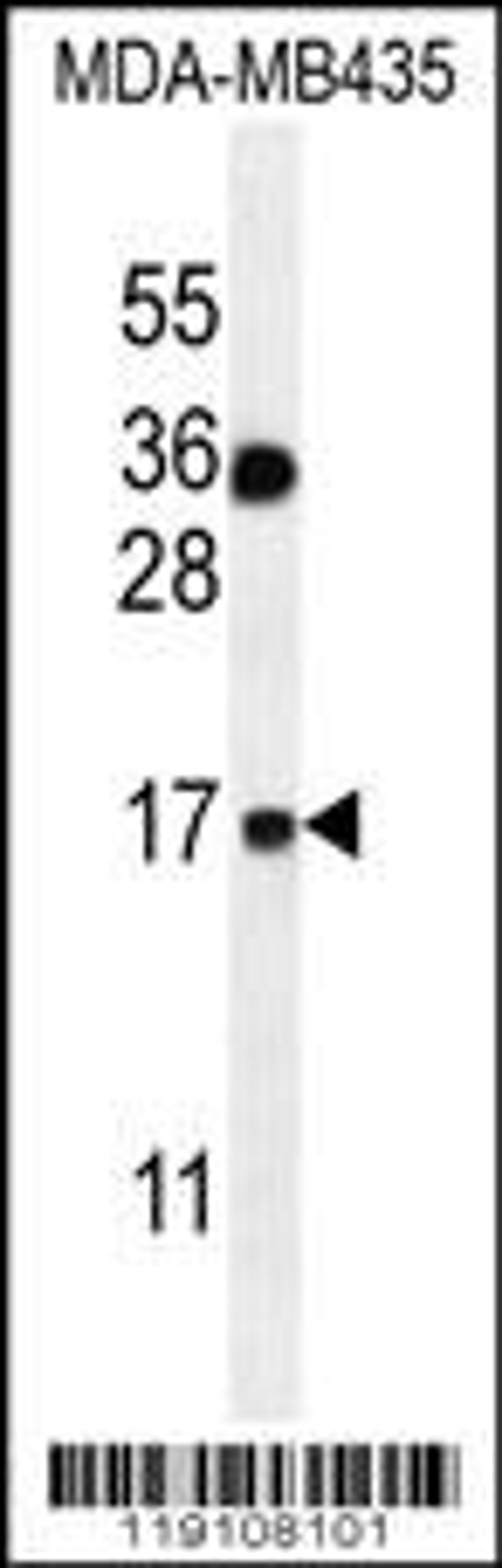 Western blot analysis in MDA-MB435 cell line lysates (35ug/lane).