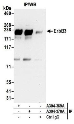 Detection of human ErbB3 by western blot of immunoprecipitates.