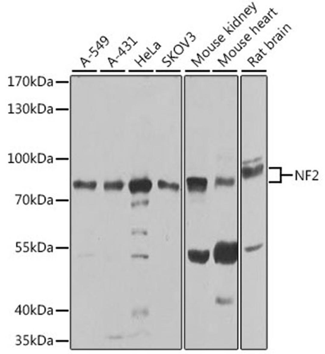 Western blot - NF2 antibody (A0739)