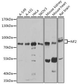 Western blot - NF2 antibody (A0739)