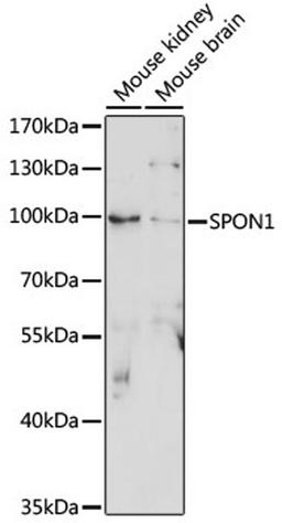 Western blot - SPON1 antibody (A15130)