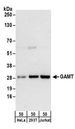 Detection of human GAMT by western blot.