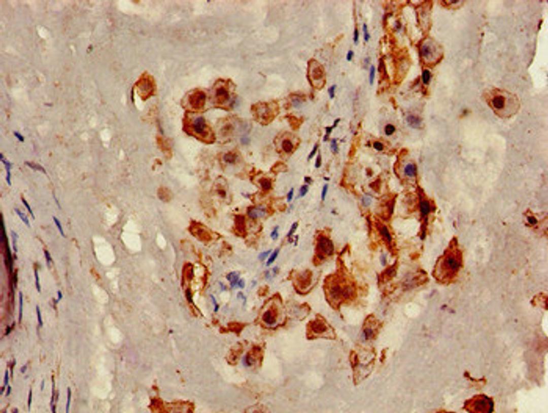 Immunohistochemistry of paraffin-embedded human placenta tissue using CSB-PA004572LA01HU at dilution of 1:100