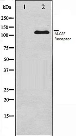 Western blot analysis of 293 whole cell lysates using M-CSF Receptor antibody, The lane on the left is treated with the antigen-specific peptide.