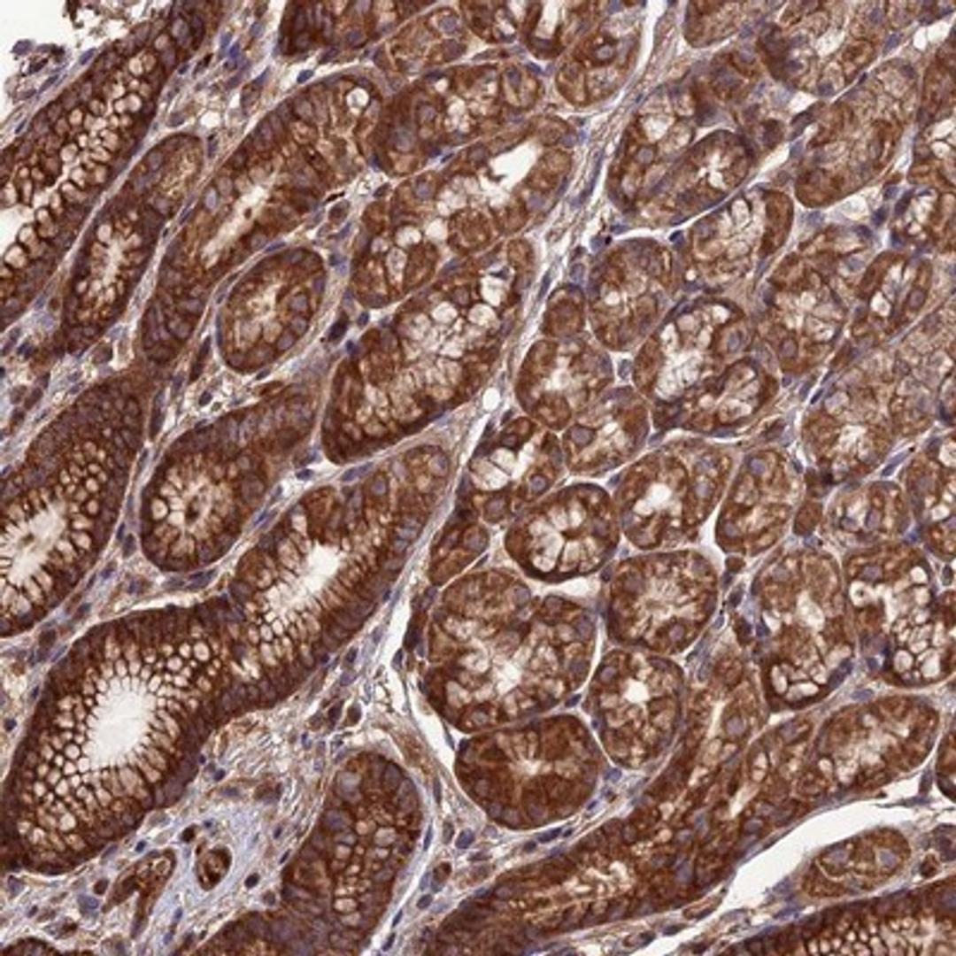 Immunohistochemistry-Paraffin: ARHGEF15 Antibody [NBP1-91679] - Staining of human stomach shows strong cytoplasmic and membranous positivity in glandular cells.