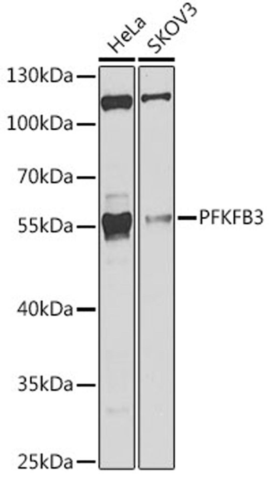 Western blot - PFKFB3 antibody (A6945)