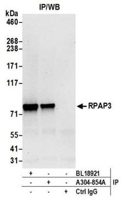 Detection of human RPAP3 by western blot of immunoprecipitates.