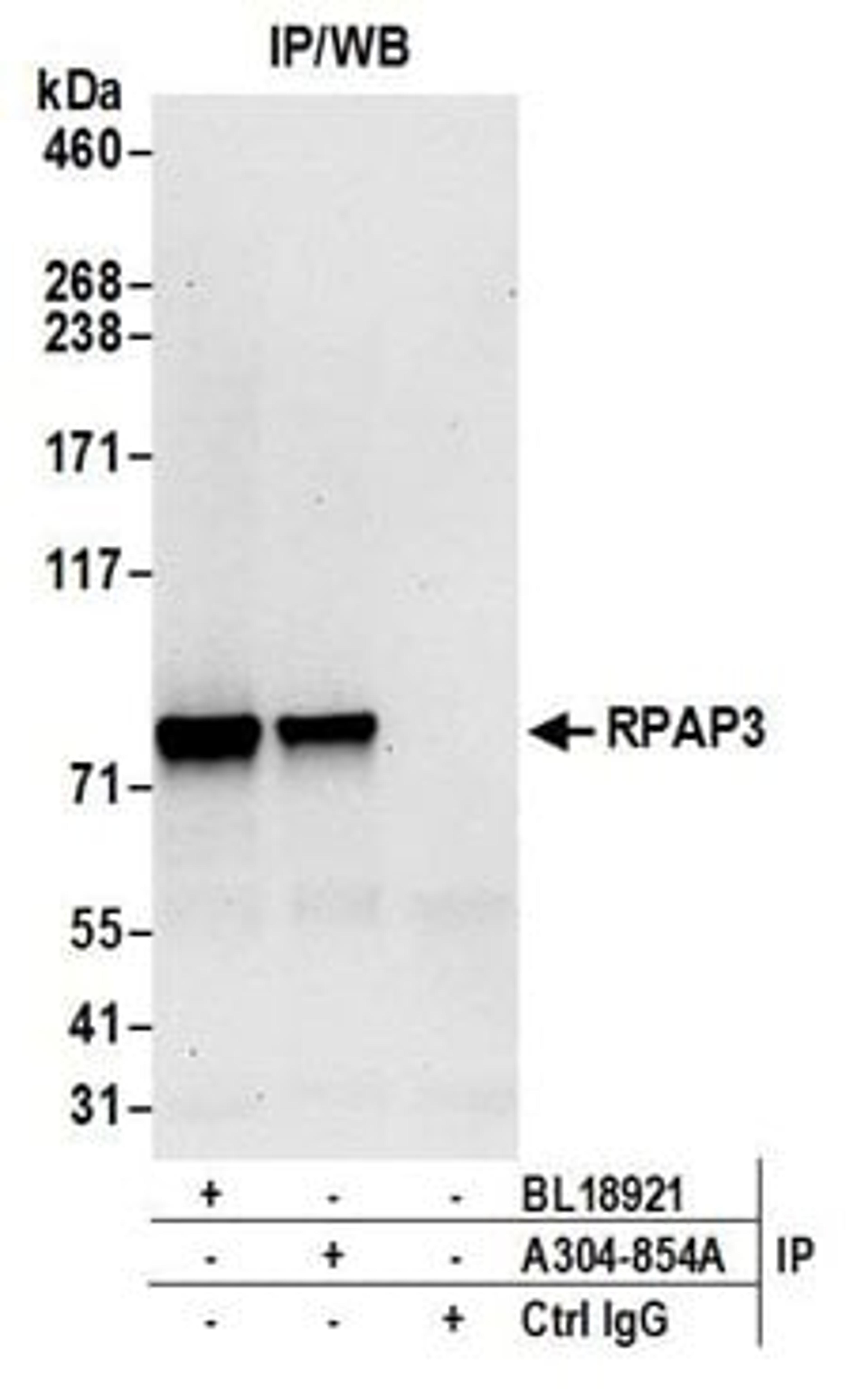 Detection of human RPAP3 by western blot of immunoprecipitates.