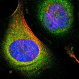 Immunocytochemistry/Immunofluorescence: OXSR1 Antibody [NBP1-82929] - Staining of human cell line U-2 OS shows positivity in cytoplasm.