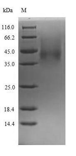 (Tris-Glycine gel) Discontinuous SDS-PAGE (reduced) with 5% enrichment gel and 15% separation gel.