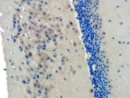 Immunohistochemical staining of paraffin embedded mouse brain tissue using BMPR2 antibody (2.5 ug/ml)