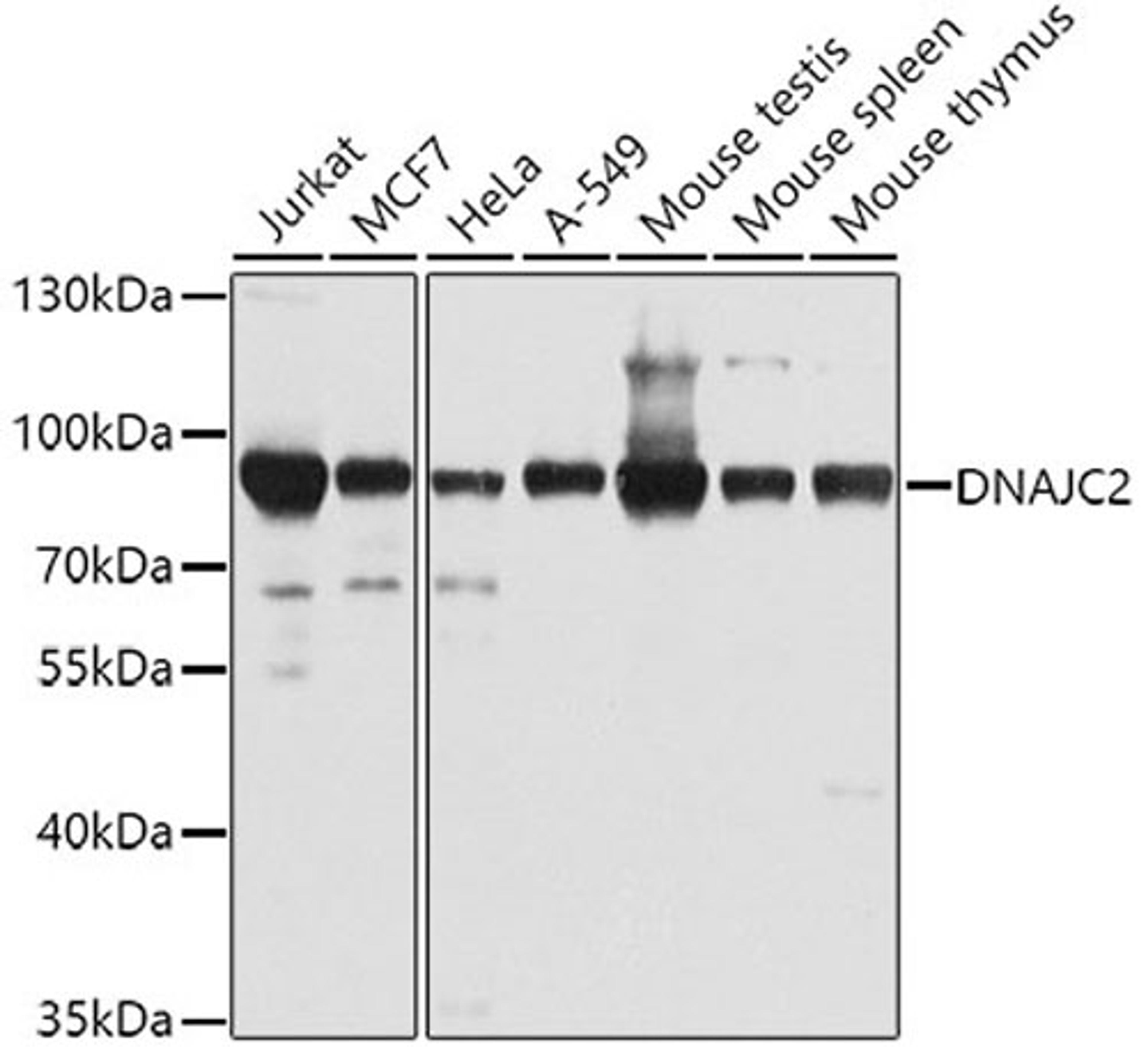 Western blot - DNAJC2 antibody (A4633)