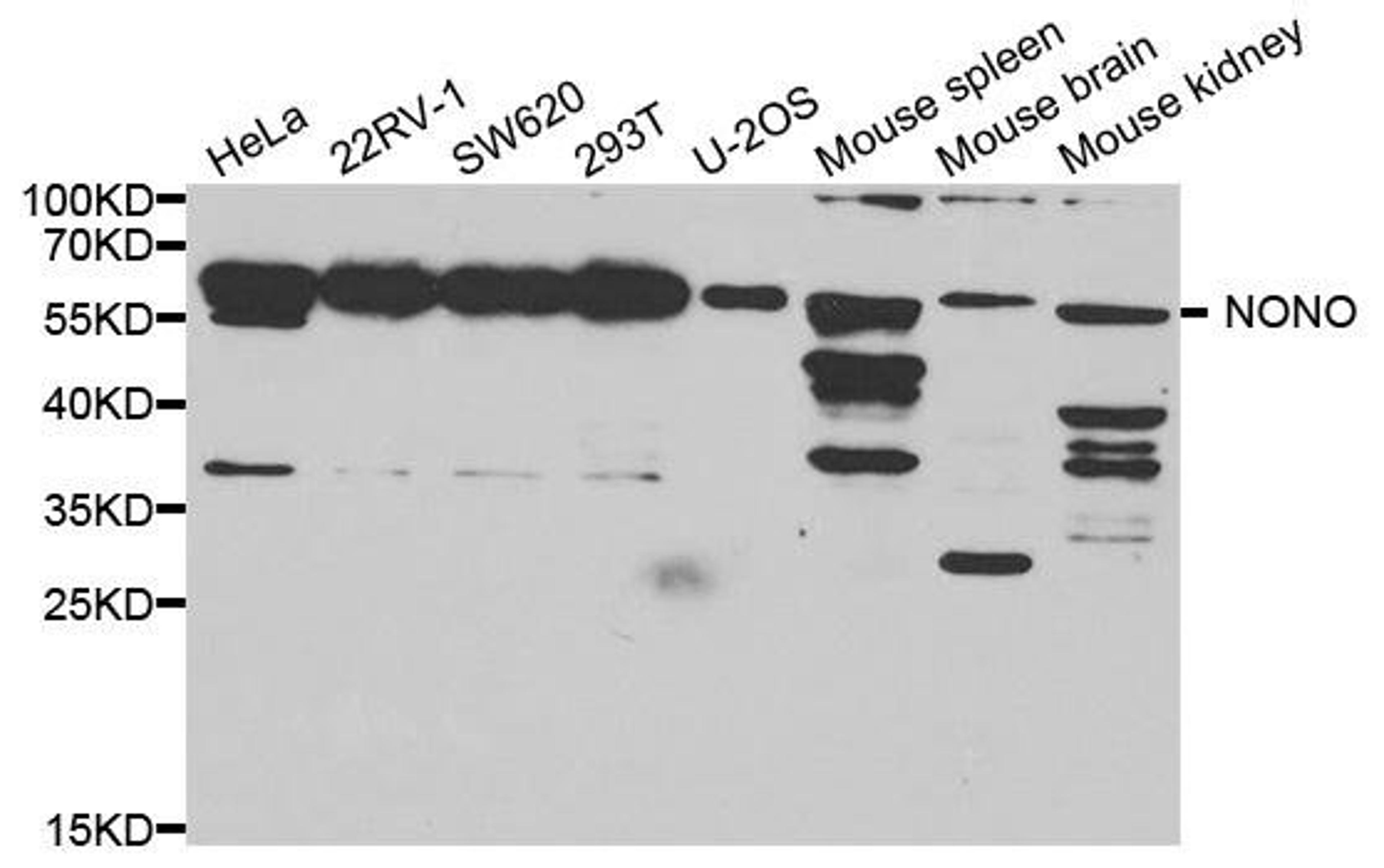 Western blot analysis of extracts of various cell lines using NONO antibody