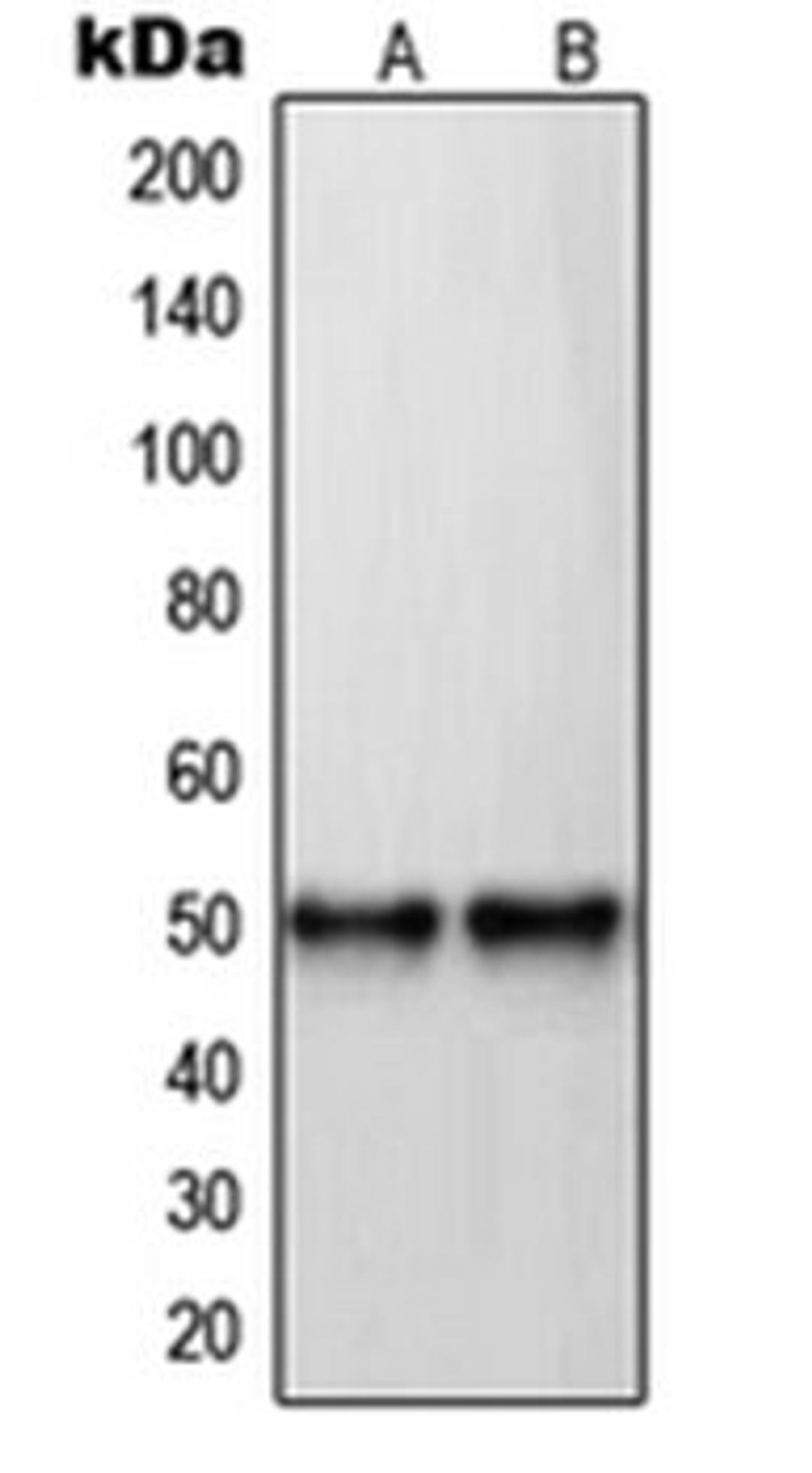 Western blot analysis of U87MG (Lane 1), MDAMB435 (Lane 2) whole cell lysates using RARB antibody