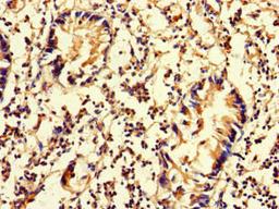 Immunohistochemistry of paraffin-embedded human appendix tissue using CSB-PA850845LA01HU at dilution of 1:100