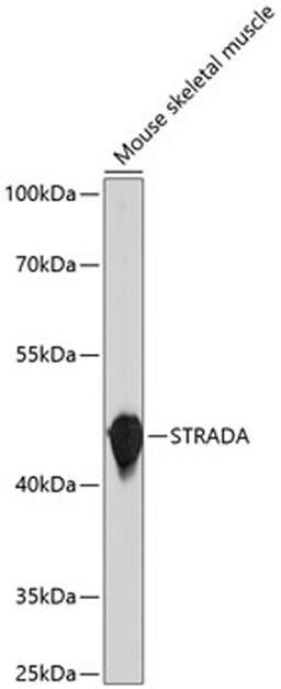 Western blot - STRADA antibody (A10336)