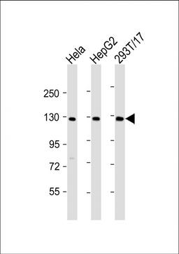 Western Blot at 1:2000 dilution Lane 1: Hela whole cell lysate Lane 2: HepG2 whole cell lysate Lane 3: 293T/17 whole cell lysate Lysates/proteins at 20 ug per lane.