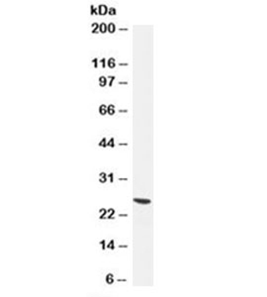 Western blot testing of human brain lysate with UchL1 antibody (clone 13C4). Predicted molecular weight ~25kDa.