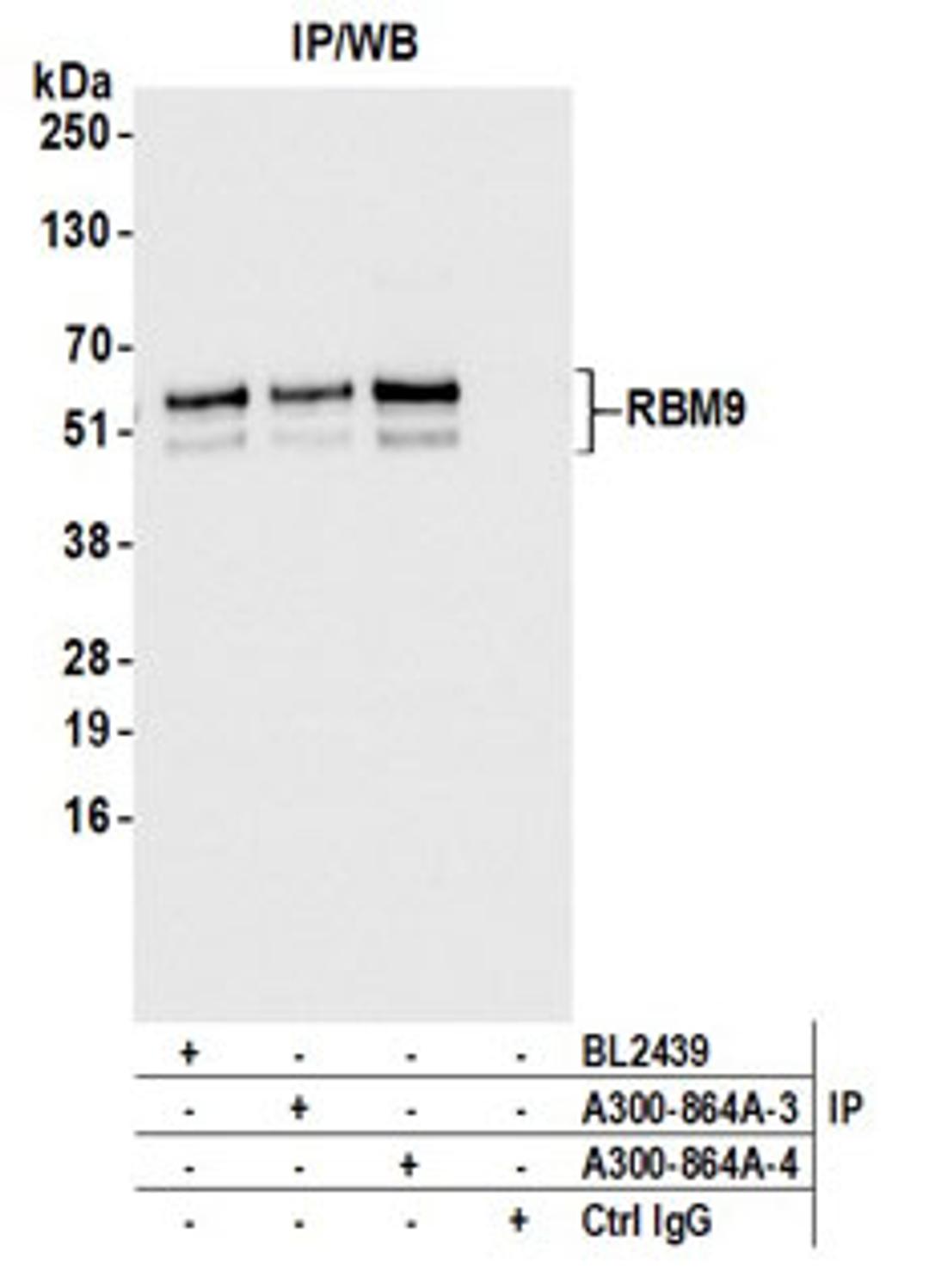 Detection of human RBM9 by western blot of immunoprecipitates.