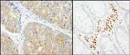 Detection of human PABP4 by immunohistochemistry.