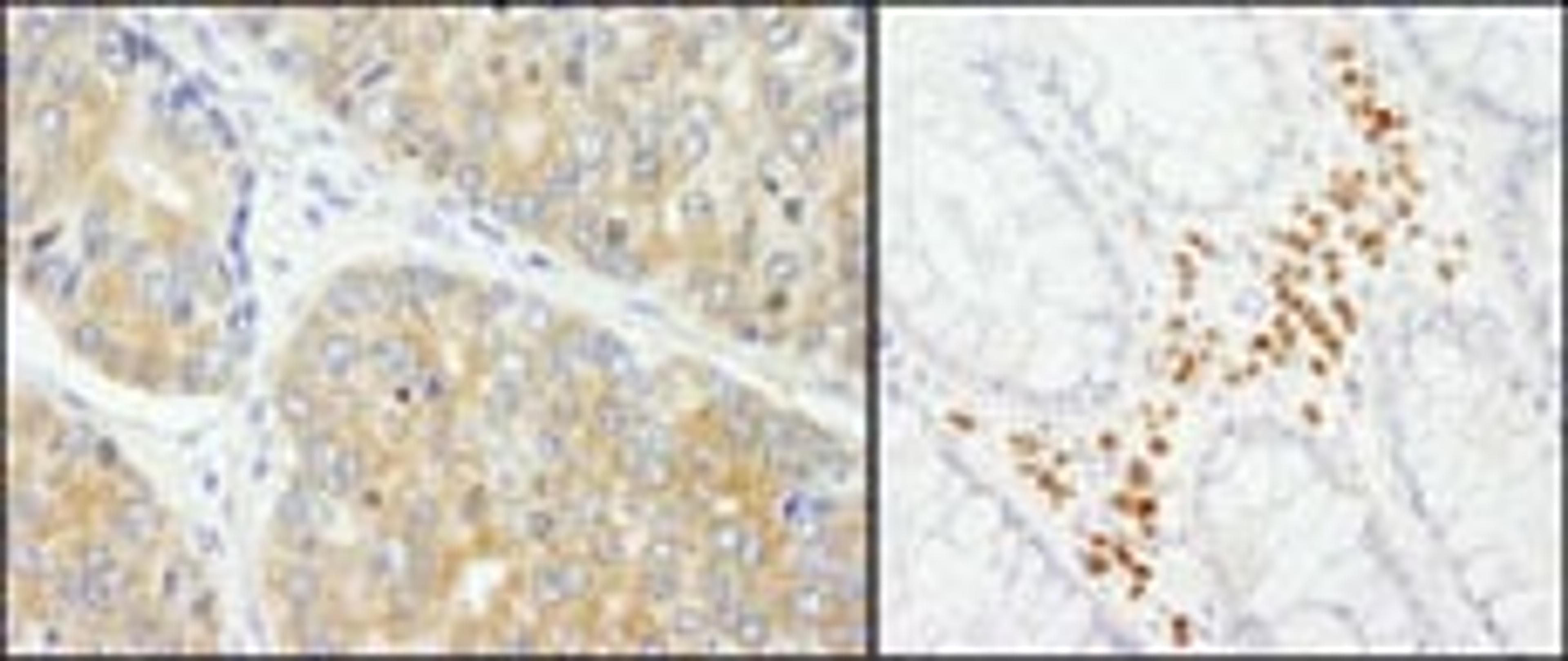 Detection of human PABP4 by immunohistochemistry.