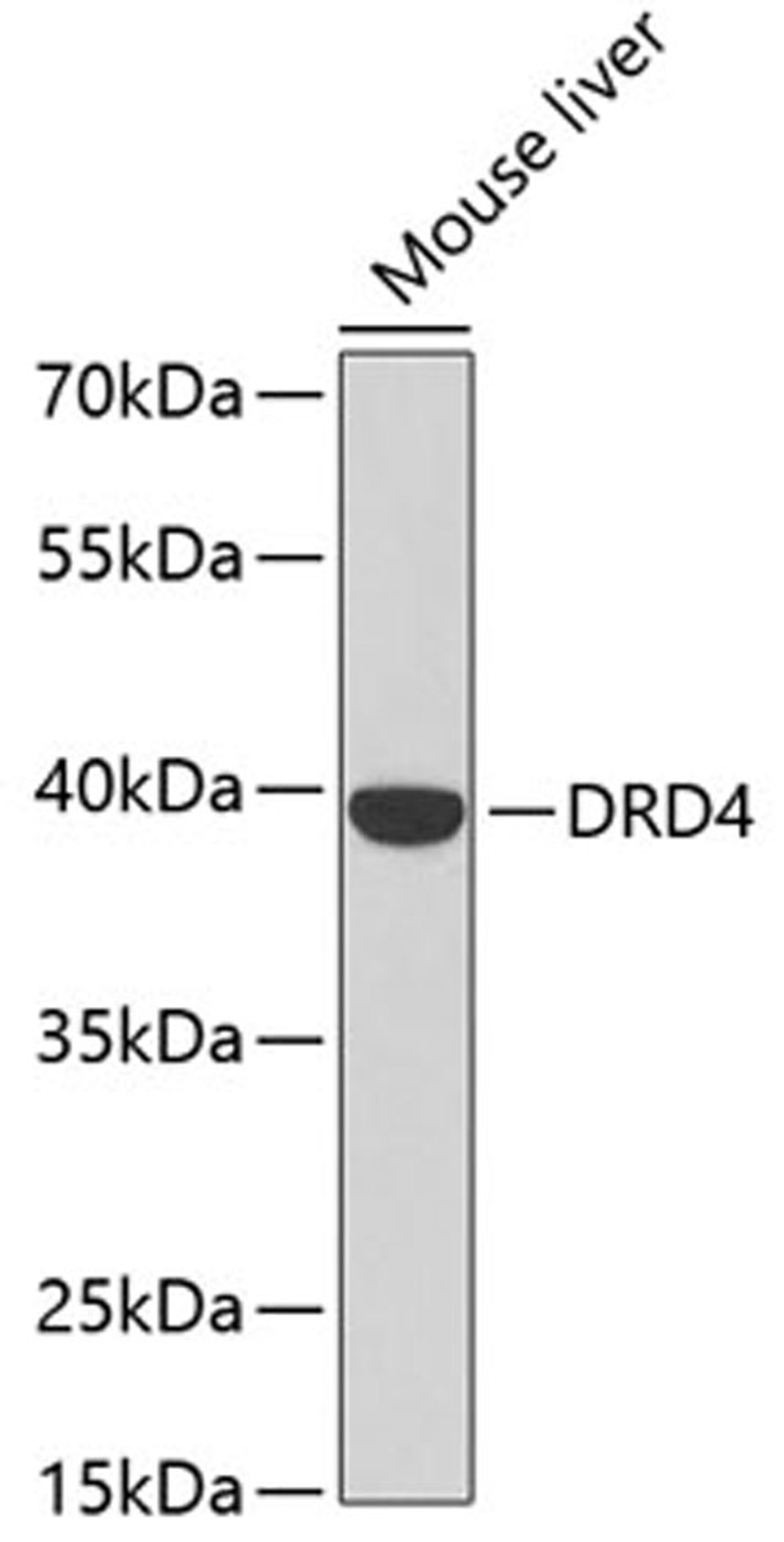 Western blot - DRD4 antibody (A2894)