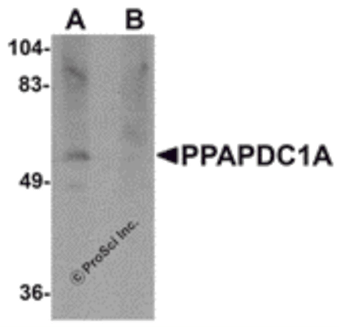 Western blot analysis of PPAPDC1A in human brain tissue lysate with PPAPDC1A antibody at 1 &#956;g/mL in (A) the absence and (B) the presence of blocking peptide.