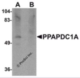 Western blot analysis of PPAPDC1A in human brain tissue lysate with PPAPDC1A antibody at 1 &#956;g/mL in (A) the absence and (B) the presence of blocking peptide.