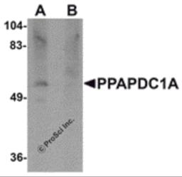 Western blot analysis of PPAPDC1A in human brain tissue lysate with PPAPDC1A antibody at 1 μg/mL in (A) the absence and (B) the presence of blocking peptide.