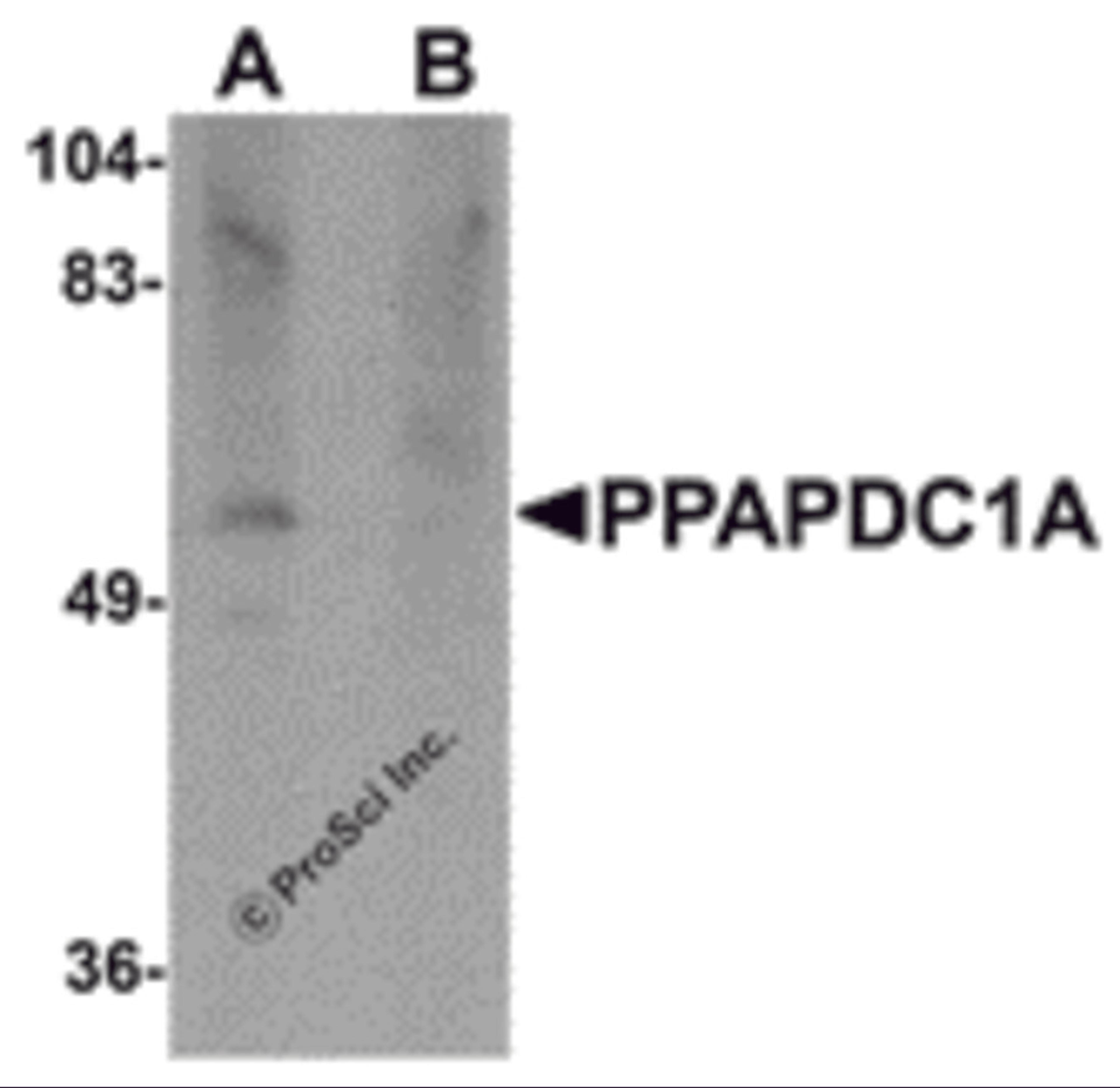 Western blot analysis of PPAPDC1A in human brain tissue lysate with PPAPDC1A antibody at 1 μg/mL in (A) the absence and (B) the presence of blocking peptide.