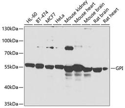 Western blot - GPI antibody (A13308)