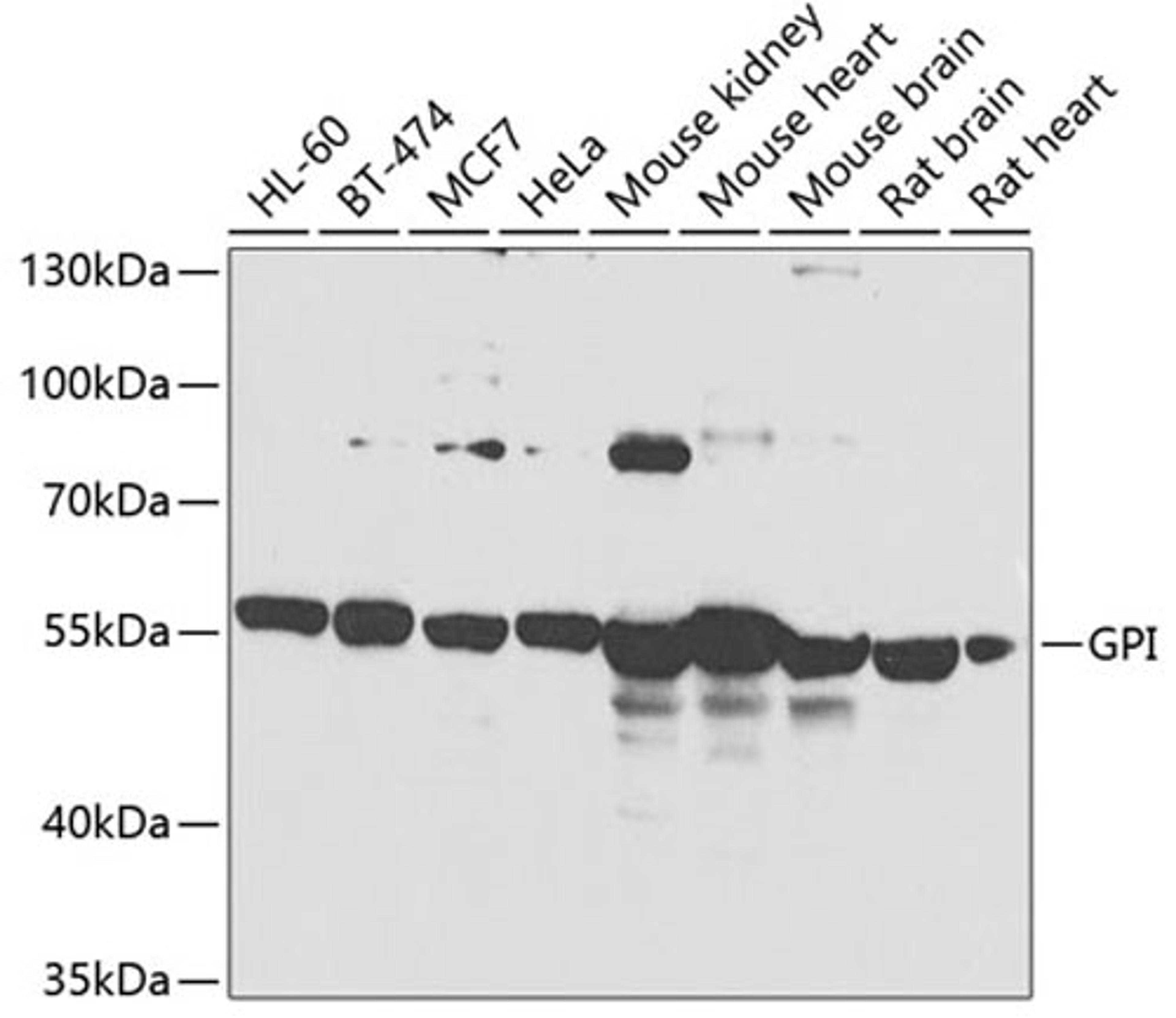 Western blot - GPI antibody (A13308)