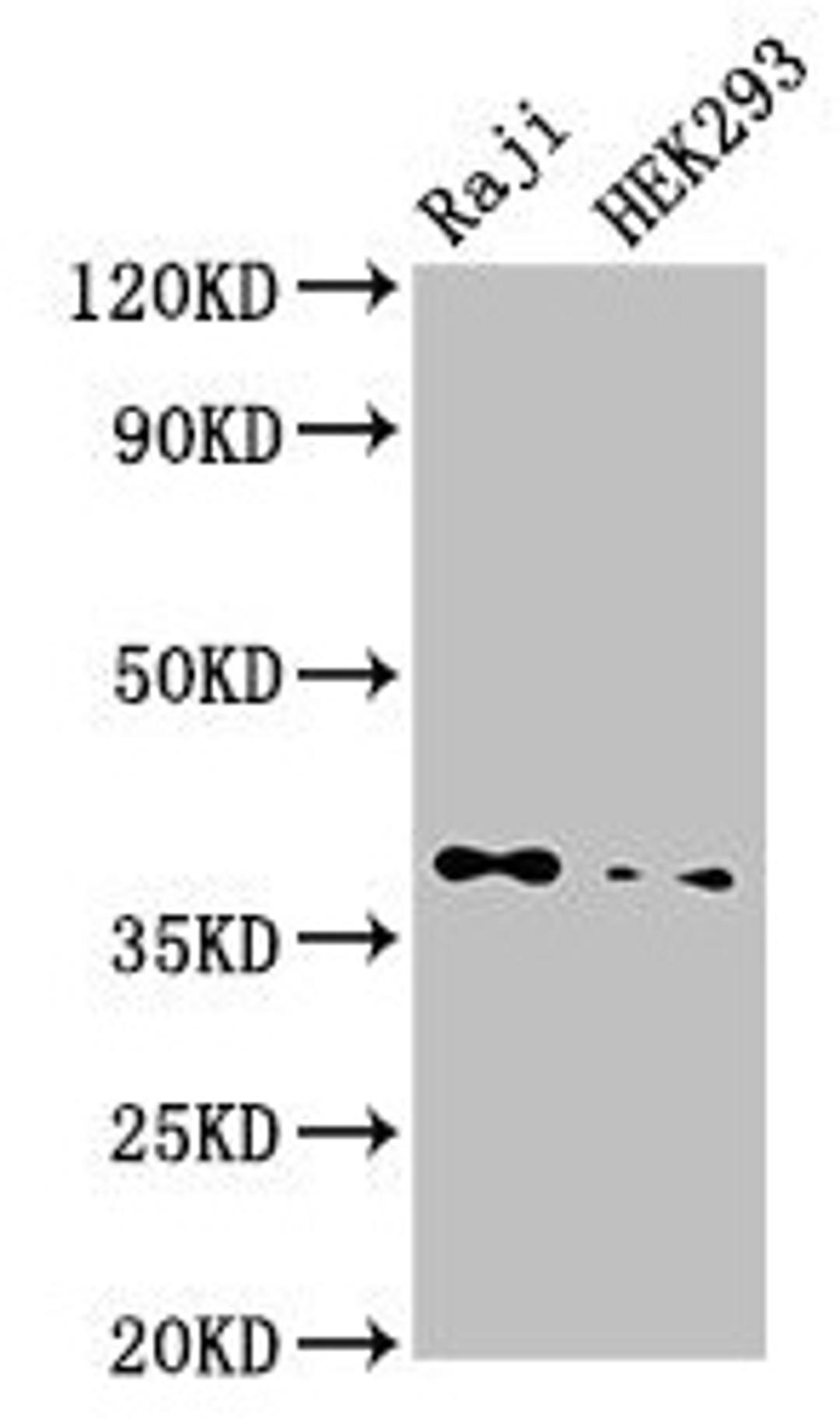 Western Blot. Positive WB detected in: Raji whole cell lysate, HEK293 whole cell lysate. All lanes: PPP1CB antibody at 3.5µg/ml. Secondary. Goat polyclonal to rabbit IgG at 1/50000 dilution. Predicted band size: 38 kDa. Observed band size: 38 kDa