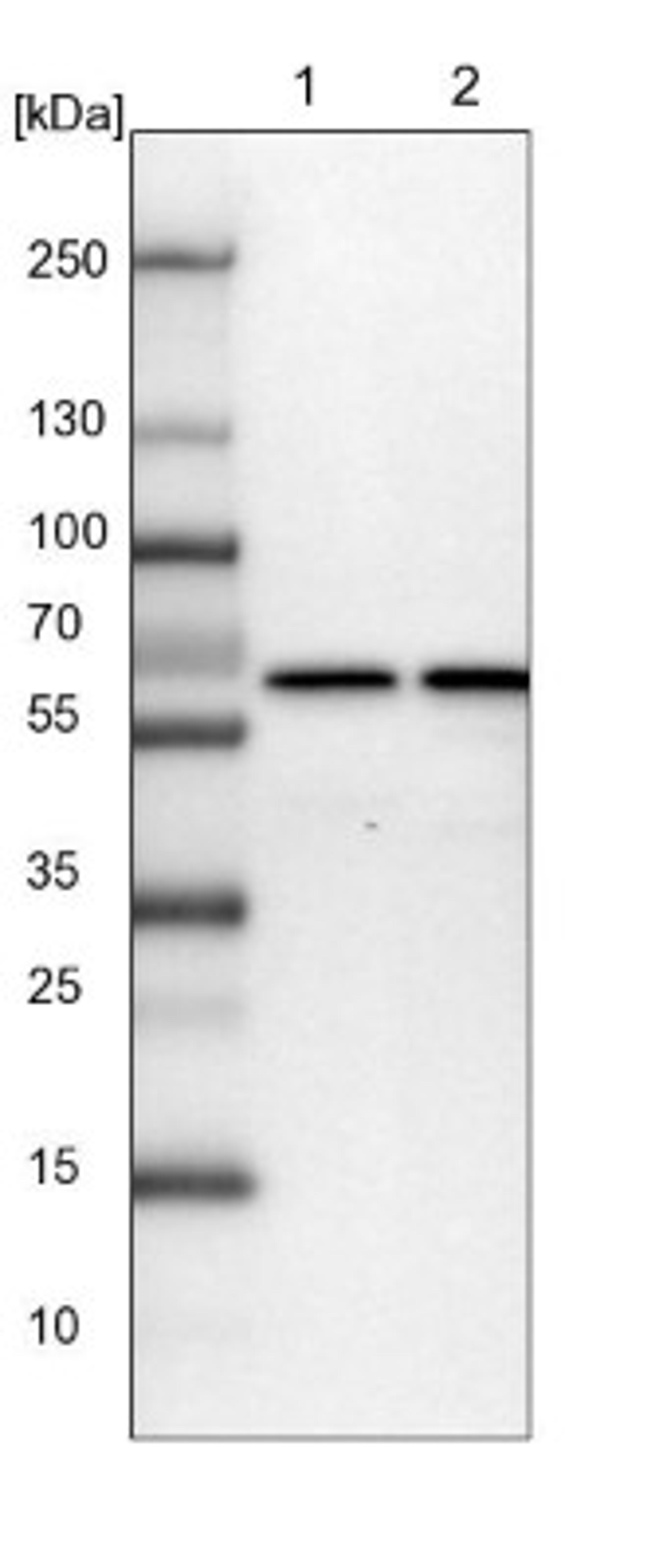 Western Blot: CCDC47 Antibody [NBP1-93717] - Lane 1: NIH-3T3 cell lysate (Mouse embryonic fibroblast cells)<br/>Lane 2: NBT-II cell lysate (Rat Wistar bladder tumour cells)