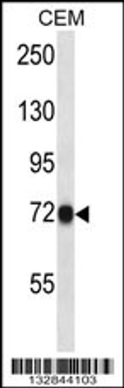 Western blot analysis in CEM cell line lysates (35ug/lane).