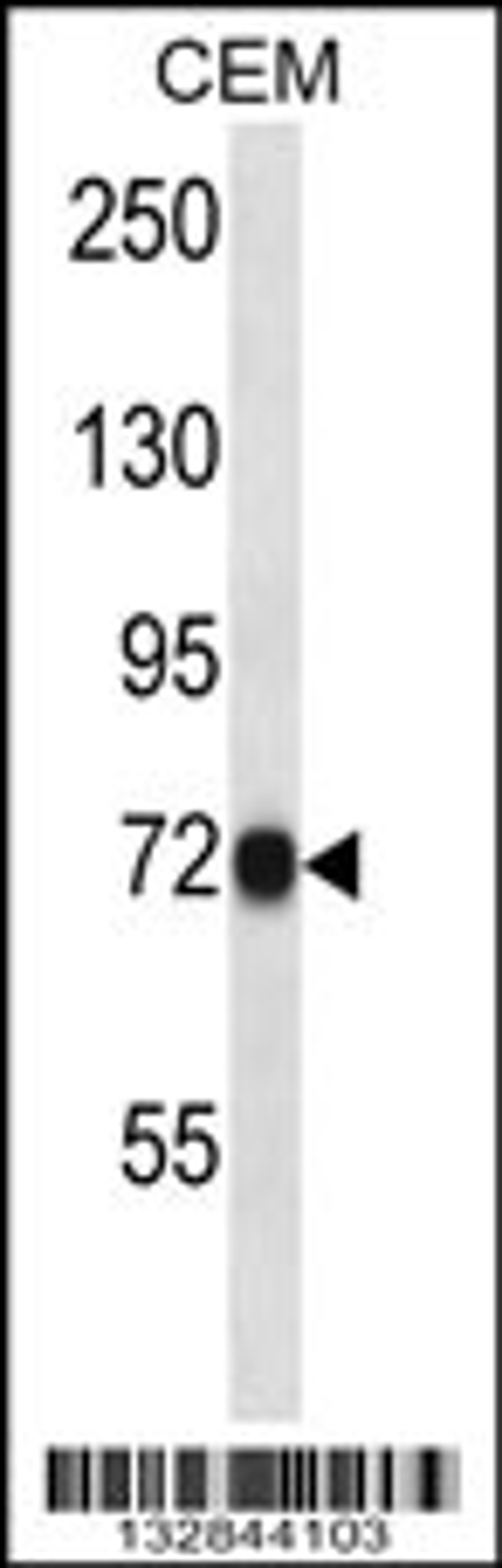 Western blot analysis in CEM cell line lysates (35ug/lane).