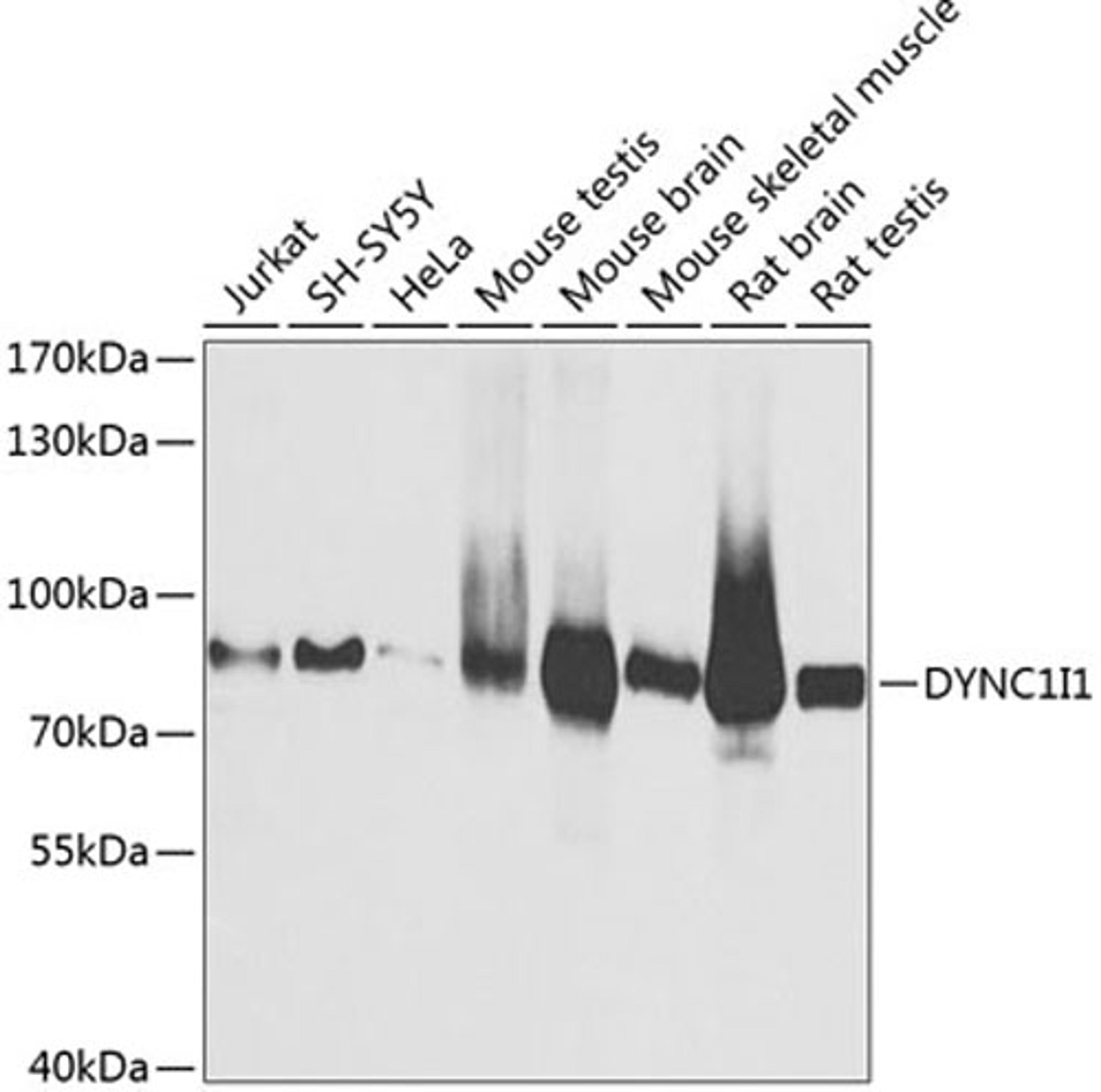 Western blot - DYNC1I1 antibody (A3833)