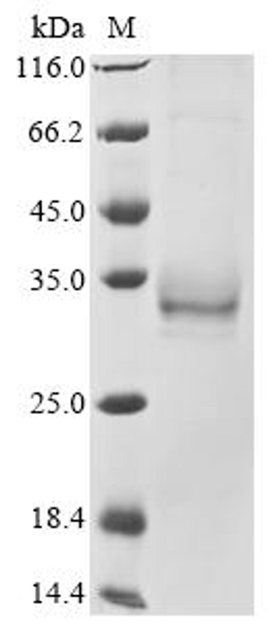 (Tris-Glycine gel) Discontinuous SDS-PAGE (reduced) with 5% enrichment gel and 15% separation gel.