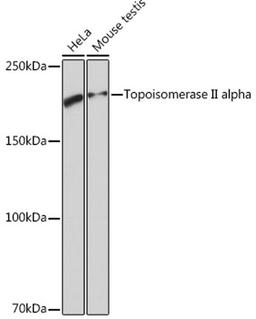 Western blot - Topoisomerase II alpha Rabbit mAb (A4389)