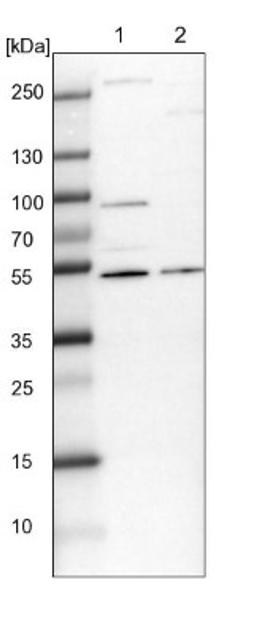 Western Blot: FBRS Antibody [NBP1-83917] - Lane 1: NIH-3T3 cell lysate (Mouse embryonic fibroblast cells)<br/>Lane 2: NBT-II cell lysate (Rat Wistar bladder tumour cells)