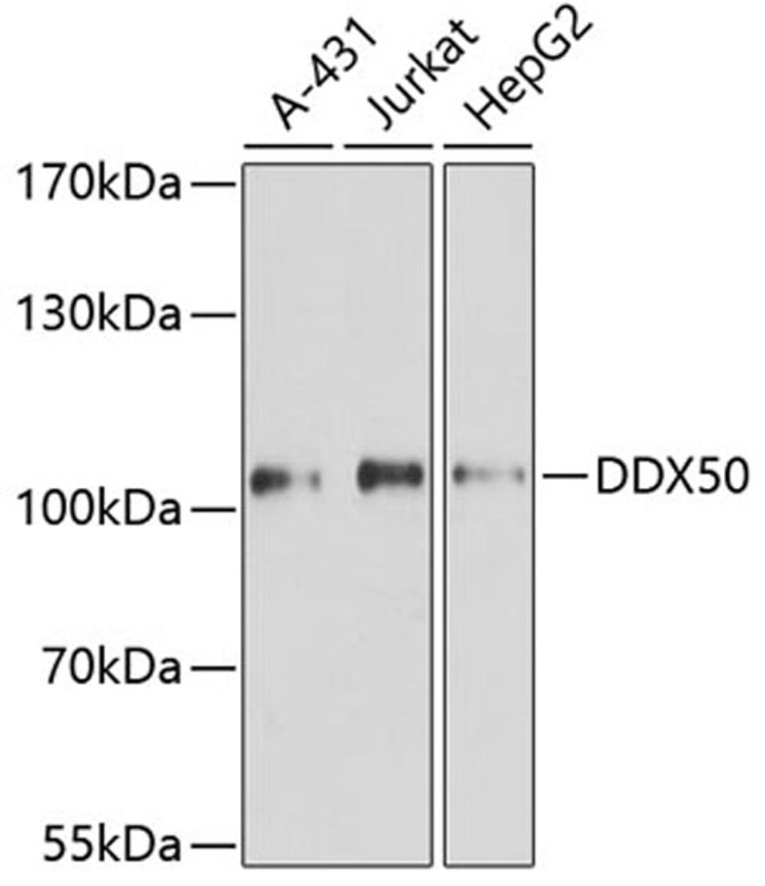 Western blot - DDX50 antibody (A8628)