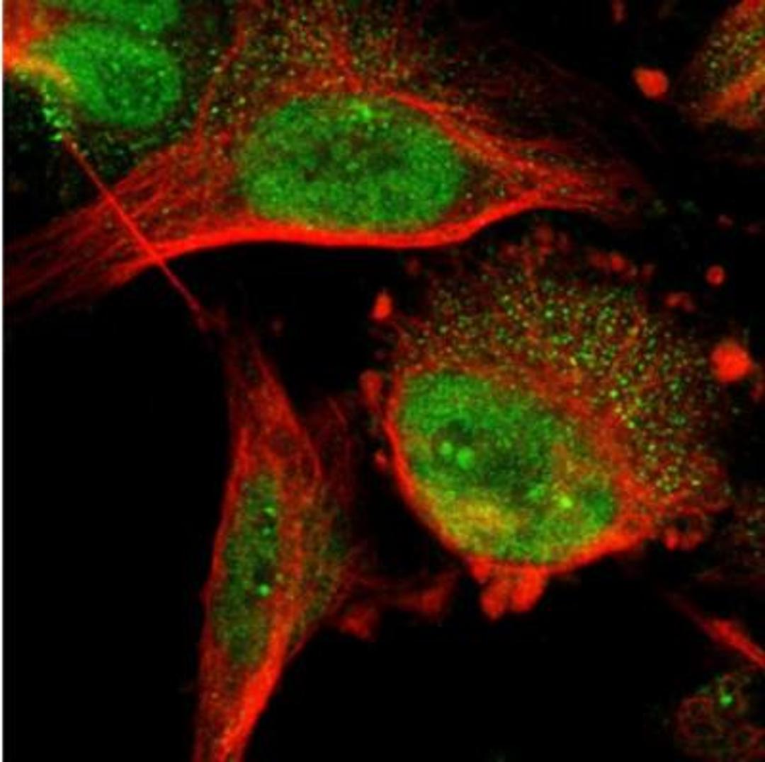 Immunocytochemistry/Immunofluorescence: DNAJC14 Antibody [NBP1-90488] - Immunofluorescent staining of human cell line U-251 MG shows positivity in nucleoli & nucleus but not nucleoli. Antibody staining is shown in green.