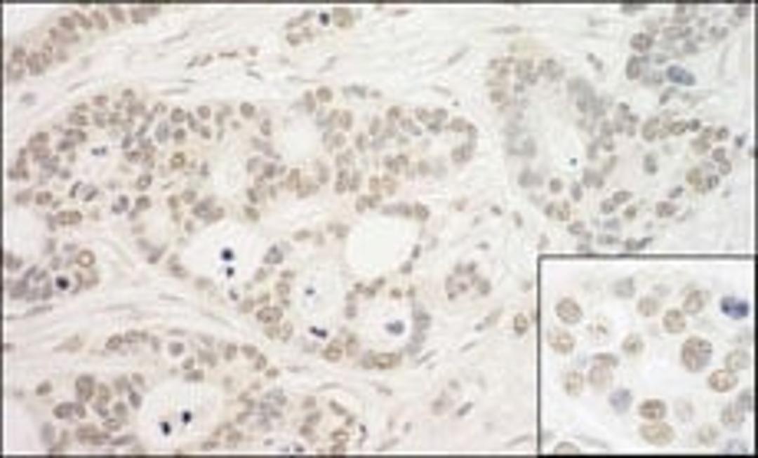 Detection of human PRP6 by immunohistochemistry.