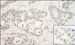 Detection of human PRP6 by immunohistochemistry.