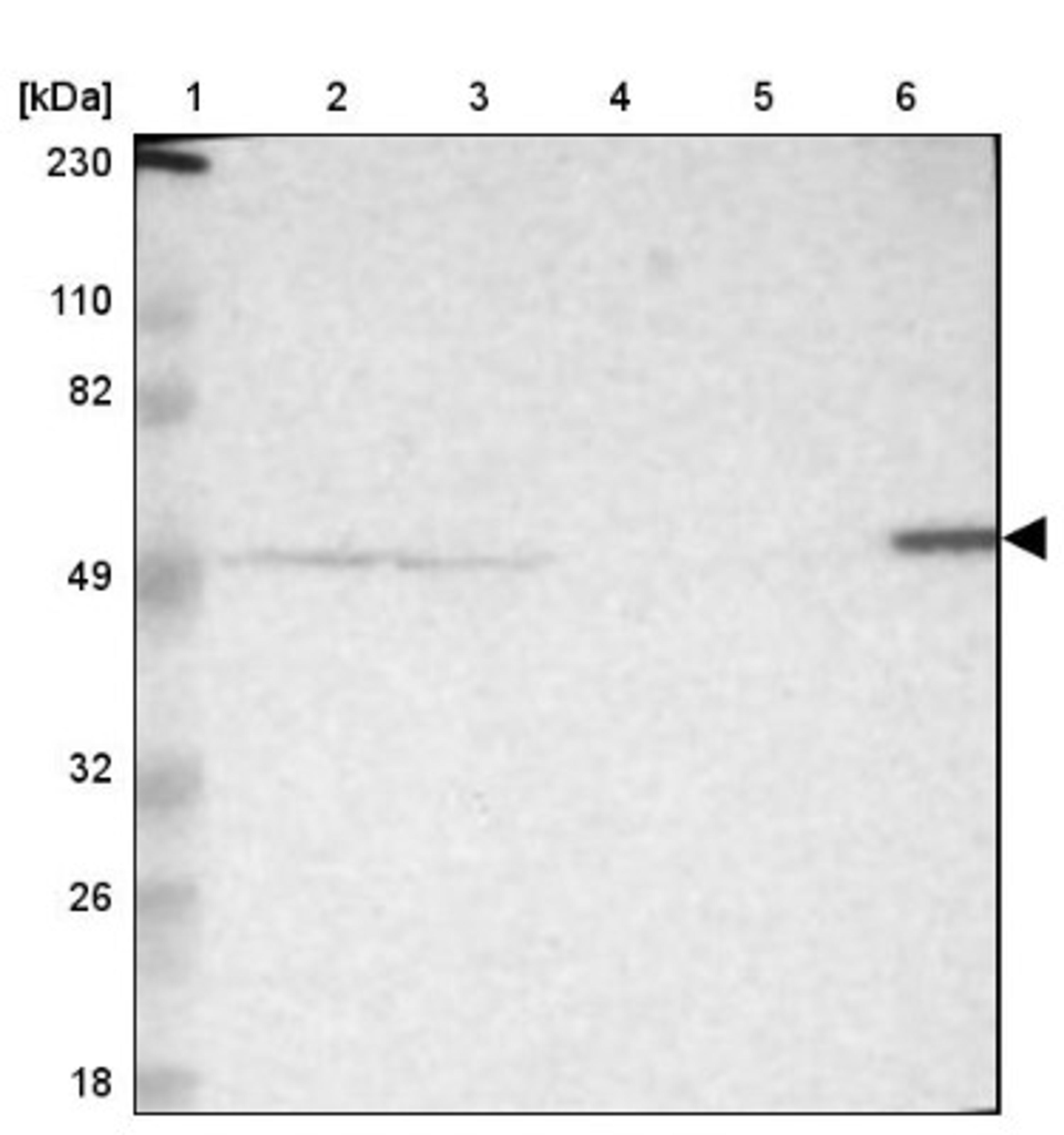 Western Blot: Septin-11 Antibody [NBP1-83824] - Lane 1: Marker [kDa] 230, 110, 82, 49, 32, 26, 18<br/>Lane 2: Human cell line RT-4<br/>Lane 3: Human cell line U-251MG sp<br/>Lane 4: Human plasma (IgG/HSA depleted)<br/>Lane 5: Human liver tissue<br/>Lane 6: Human tonsil tissue