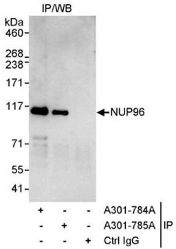 Detection of human NUP96 by western blot of immunoprecipitates.