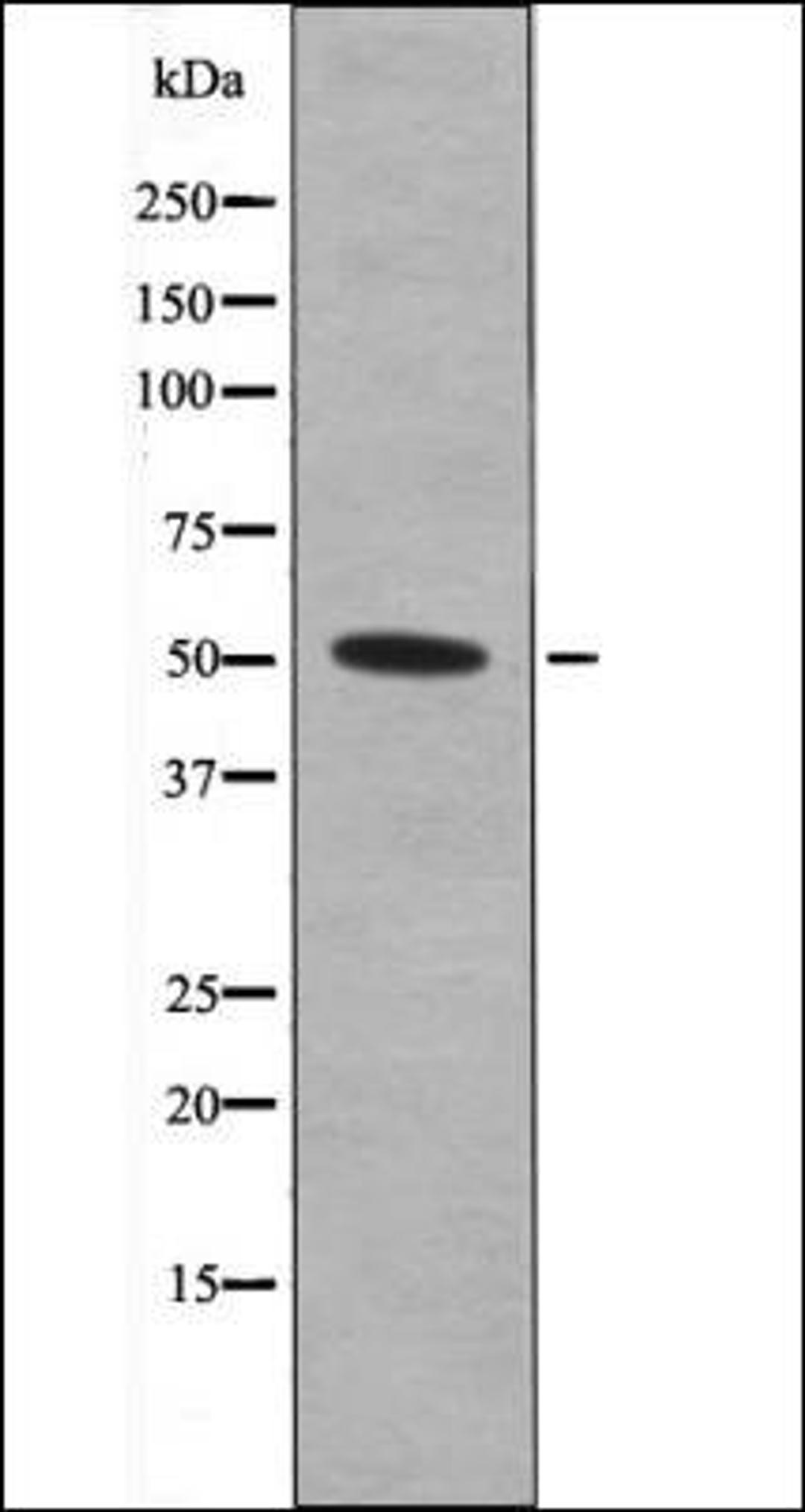 Western blot analysis of TNF treated Jurkat whole cell lysates using MNK1 -Phospho-Thr250- antibody