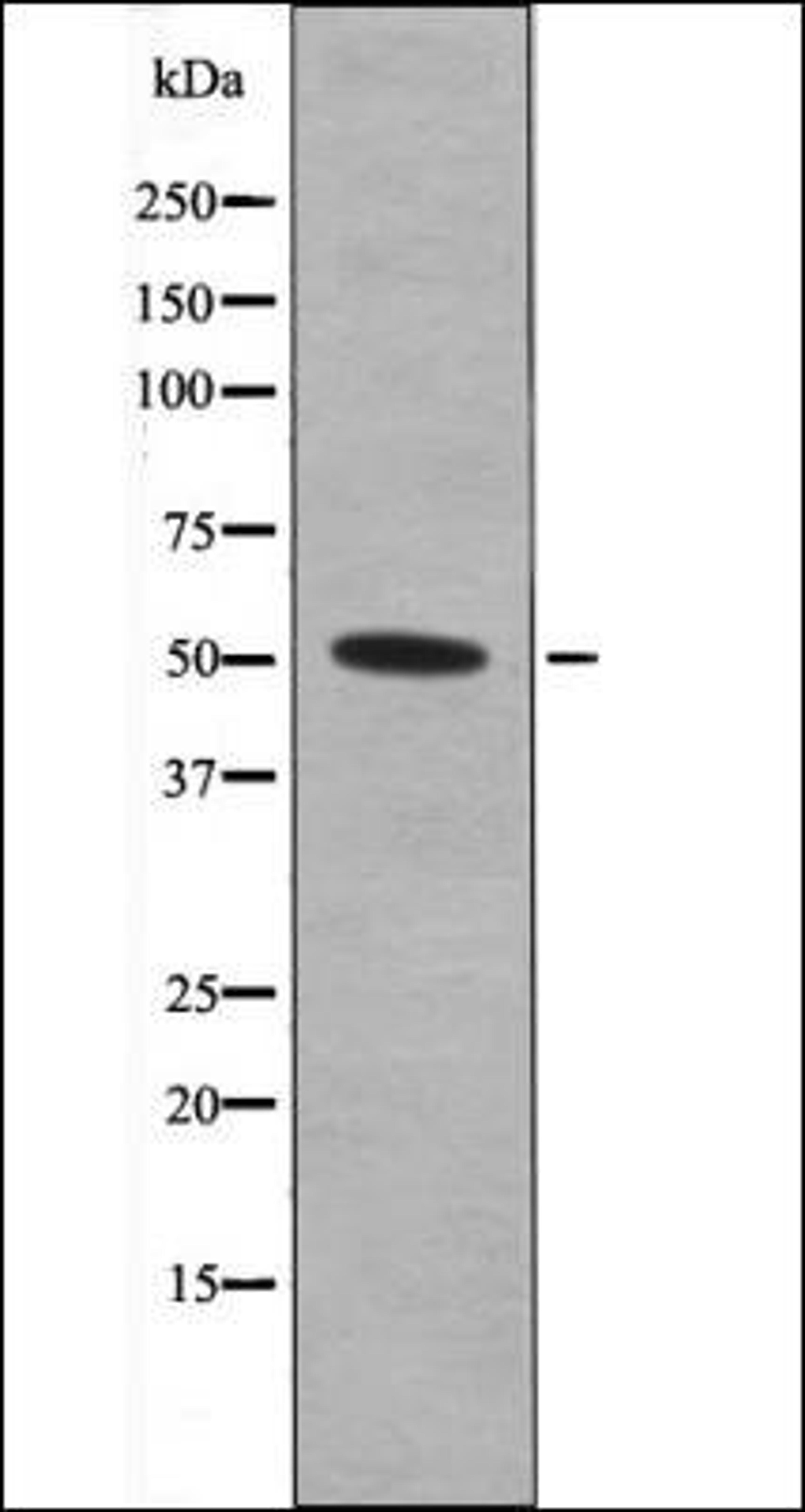 Western blot analysis of TNF treated Jurkat whole cell lysates using MNK1 -Phospho-Thr250- antibody