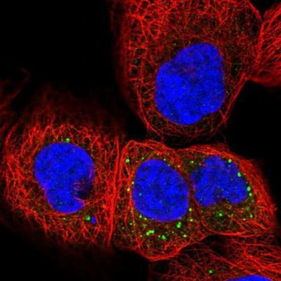 Immunocytochemistry/Immunofluorescence: PHLDA3 Antibody [NBP1-80683] - Staining of human cell line A-431 shows positivity in vesicles.