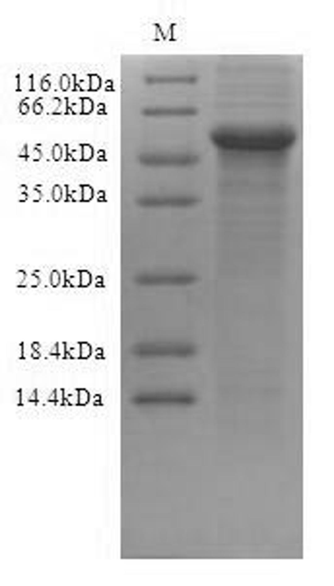 (Tris-Glycine gel) Discontinuous SDS-PAGE (reduced) with 5% enrichment gel and 15% separation gel.